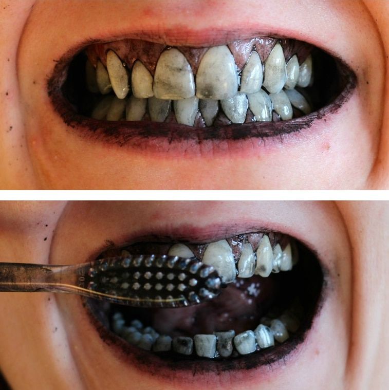 Blanchir naturellement ses dents avec le charbon de bois pour les dents